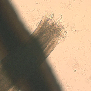 Case189_C.jpg Case189_C