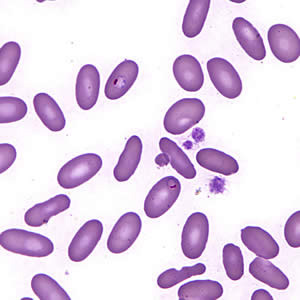 February - 2007 - Case #197