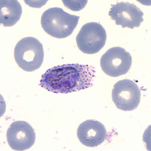 Case202_E.jpg Case202