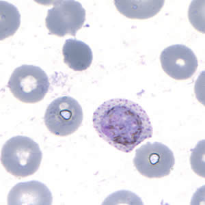 Case202_F.jpg Case202