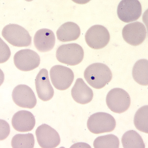 Case203_C.jpg Case203