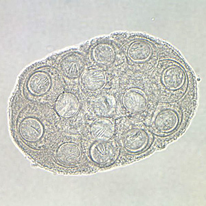 Case204_D.jpg Case204