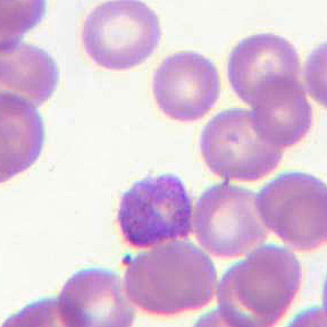 Case205_B.jpg Case205