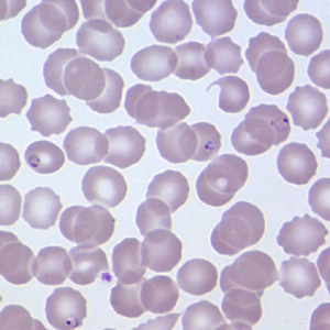 August - 2007 - Case #209