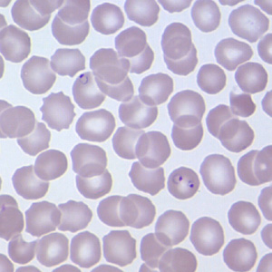 Case209_B.jpg Case209