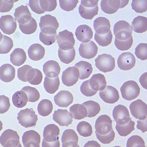 Case209_D.jpg Case209