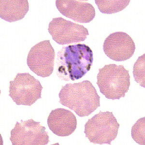 Case211_A.jpg Case211