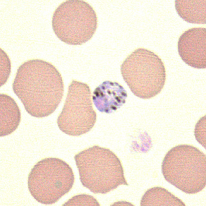 Case211_D.jpg Case211