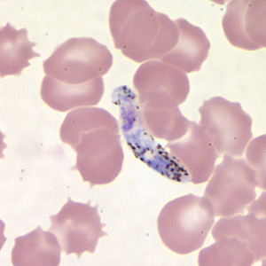 Case211_H.jpg Case211