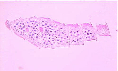 Case212_A.jpg Case212