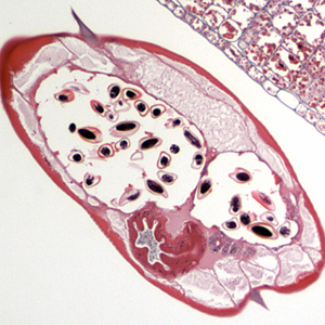 Case213_A.jpg Case213