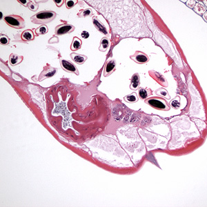 Case213_B.jpg Case213