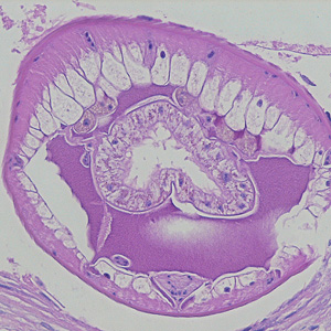 Case215_A.jpg Case215