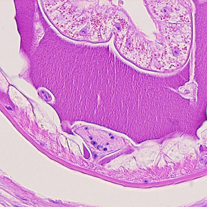 Case215_D.jpg Case215