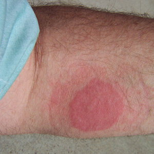 January - 2008 - Case #219