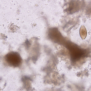 February - 2008 - Case #221