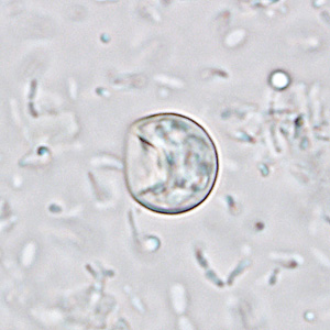 Case233_A.jpg Case233_A