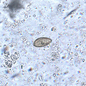 Case235_F.jpg Case235_F