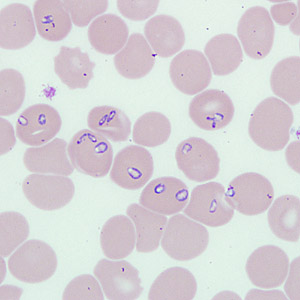 October - 2009 - Case #262