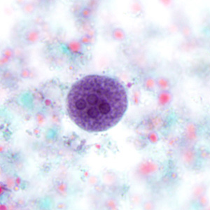 Case280_A.jpg Case280_A