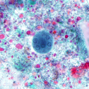 Case280_B.jpg Case280_B