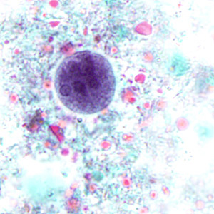 Case280_C.jpg Case280_C