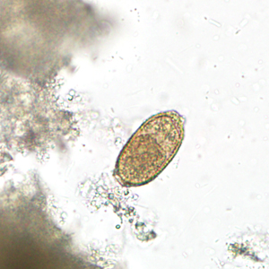 May - 2011 - Case #300