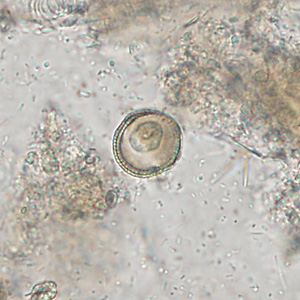 October - 2011 - Case #309