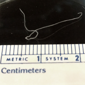 June - 2012 - Case #325