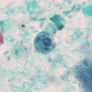 July - 2012 - Case #327