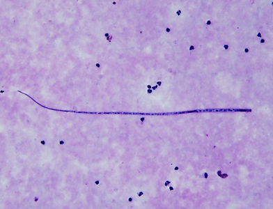 January - 2013 - Case #339