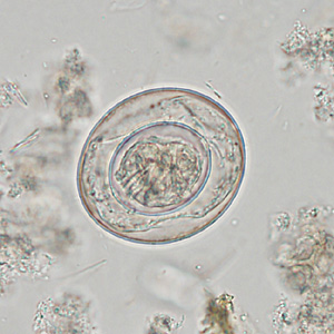 February - 2013 - Case #342