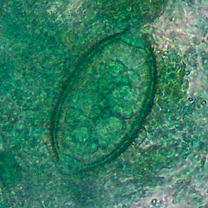 March - 2013 - Case #343