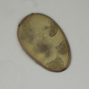 May - 2013 - Case #348