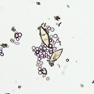 June - 2013 - Case #349