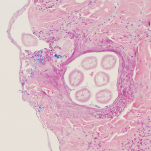 July - 2013 - Case #352