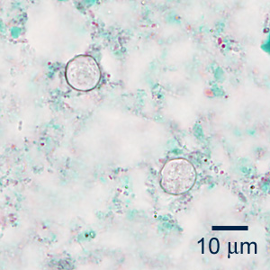 August - 2013 - Case #353