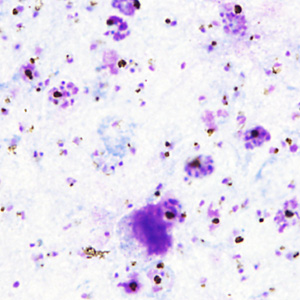 October - 2013 - Case #357