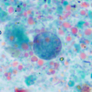 November - 2013 - Case #360