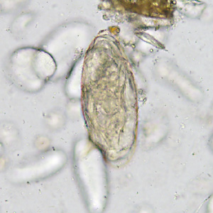 February - 2014 - Case #365