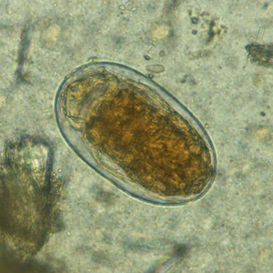 March - 2014 - Case #367