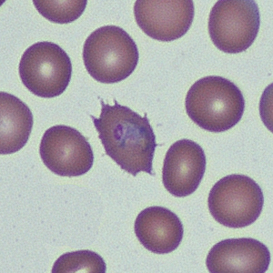 March - 2014 - Case #368