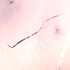 April - 2014 - Case #370