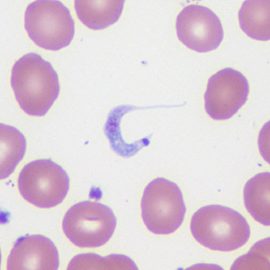 May - 2014 - Case #372