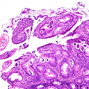 September - 2014 - Case #380