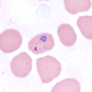 December - 2014 - Case #385