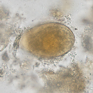 January - 2015 - Case #388