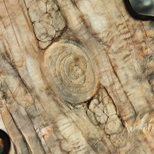 February - 2015 - Case #389