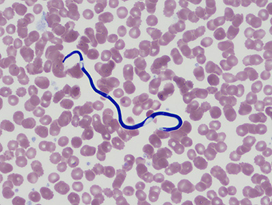 February - 2015 - Case #390