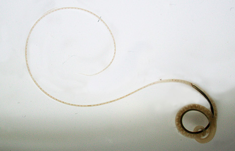 April - 2015 - Case #393